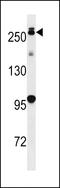 Leucine Rich Repeat Kinase 2 antibody, 62-663, ProSci, Western Blot image 