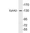 Ephrin type-A receptor 2 antibody, LS-C199847, Lifespan Biosciences, Western Blot image 