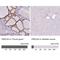 Protein Kinase C Substrate 80K-H antibody, NBP2-38492, Novus Biologicals, Immunohistochemistry paraffin image 
