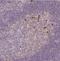 Protein Tyrosine Phosphatase Receptor Type J antibody, NBP1-86547, Novus Biologicals, Immunohistochemistry paraffin image 