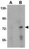 Protein Inhibitor Of Activated STAT 2 antibody, GTX31411, GeneTex, Western Blot image 