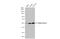 Inhibin Subunit Beta A antibody, GTX108405, GeneTex, Western Blot image 