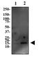 GLIPR2 antibody, NBP2-47126, Novus Biologicals, Western Blot image 