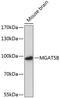 Alpha-1,6-Mannosylglycoprotein 6-Beta-N-Acetylglucosaminyltransferase B antibody, 15-243, ProSci, Western Blot image 