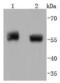 Phosphatase And Tensin Homolog antibody, A00006S380, Boster Biological Technology, Western Blot image 