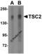 TSC Complex Subunit 2 antibody, 3509, ProSci, Western Blot image 