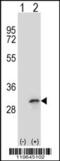 Four And A Half LIM Domains 1 antibody, 62-501, ProSci, Western Blot image 