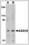 N-Acylsphingosine Amidohydrolase 2 antibody, AP23470PU-N, Origene, Western Blot image 