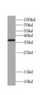 TNF Alpha Induced Protein 1 antibody, FNab08817, FineTest, Western Blot image 