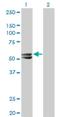 3-Hydroxy-3-Methylglutaryl-CoA Synthase 2 antibody, H00003158-M06, Novus Biologicals, Western Blot image 