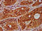 TNF Receptor Superfamily Member 18 antibody, LS-C681581, Lifespan Biosciences, Immunohistochemistry paraffin image 