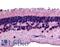 Receptor-type tyrosine-protein phosphatase mu antibody, LS-A2864, Lifespan Biosciences, Immunohistochemistry paraffin image 