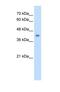 Glutaryl-CoA Dehydrogenase antibody, NBP1-54737, Novus Biologicals, Western Blot image 