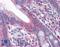 FAS antibody, LS-B4405, Lifespan Biosciences, Immunohistochemistry paraffin image 