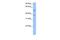 Coiled-coil domain-containing protein 78 antibody, GTX45581, GeneTex, Western Blot image 