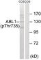 ABL Proto-Oncogene 1, Non-Receptor Tyrosine Kinase antibody, 79-839, ProSci, Western Blot image 