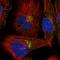 Chromosome 16 Open Reading Frame 58 antibody, HPA024406, Atlas Antibodies, Immunofluorescence image 