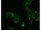 Non-structural protein 9 antibody, NBP2-21671, Novus Biologicals, Immunofluorescence image 