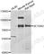 SET Domain Bifurcated Histone Lysine Methyltransferase 2 antibody, A7391, ABclonal Technology, Western Blot image 