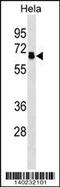 Protein Phosphatase 2 Regulatory Subunit B'Delta antibody, 60-468, ProSci, Western Blot image 