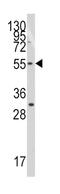 Telomeric Repeat Binding Factor 1 antibody, abx031691, Abbexa, Western Blot image 