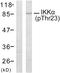 Component Of Inhibitor Of Nuclear Factor Kappa B Kinase Complex antibody, LS-C117384, Lifespan Biosciences, Western Blot image 