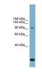 Solute Carrier Family 12 Member 4 antibody, NBP1-58293, Novus Biologicals, Western Blot image 