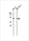Vomeronasal 1 Receptor 5 (Gene/Pseudogene) antibody, PA5-49565, Invitrogen Antibodies, Western Blot image 