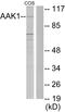 AP2 Associated Kinase 1 antibody, LS-C119088, Lifespan Biosciences, Western Blot image 