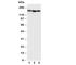 Collagen Type IV Alpha 1 Chain antibody, R30612, NSJ Bioreagents, Western Blot image 