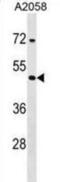 Tetrapeptide Repeat Homeobox 1 antibody, abx029152, Abbexa, Western Blot image 