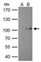 SATB Homeobox 1 antibody, PA5-30163, Invitrogen Antibodies, Immunoprecipitation image 