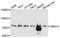 Bardet-Biedl Syndrome 10 antibody, A8820, ABclonal Technology, Western Blot image 