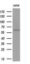 Glucosylceramidase Beta antibody, MA5-26591, Invitrogen Antibodies, Western Blot image 