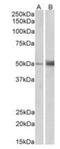 Forkhead Box L2 antibody, orb66485, Biorbyt, Western Blot image 