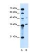 Armadillo Repeat Containing X-Linked 6 antibody, NBP1-91581, Novus Biologicals, Western Blot image 