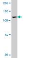 Receptor Tyrosine Kinase Like Orphan Receptor 1 antibody, MCA3305Z, Bio-Rad (formerly AbD Serotec) , Western Blot image 