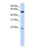 Acy1l2 antibody, NBP1-70678, Novus Biologicals, Western Blot image 