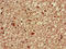 Activator Of Basal Transcription 1 antibody, LS-C672801, Lifespan Biosciences, Immunohistochemistry paraffin image 