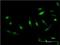Cullin Associated And Neddylation Dissociated 1 antibody, H00055832-M05, Novus Biologicals, Immunocytochemistry image 