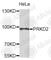 Protein Kinase D2 antibody, A8735, ABclonal Technology, Western Blot image 