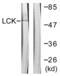 LCK Proto-Oncogene, Src Family Tyrosine Kinase antibody, LS-C117666, Lifespan Biosciences, Western Blot image 
