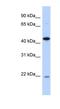 NIN1 (RPN12) Binding Protein 1 Homolog antibody, NBP1-55404, Novus Biologicals, Western Blot image 