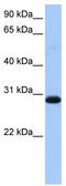 Tryptophanyl TRNA Synthetase 2, Mitochondrial antibody, TA340184, Origene, Western Blot image 