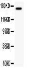 Mitogen-Activated Protein Kinase Kinase Kinase 1 antibody, PA1923, Boster Biological Technology, Western Blot image 