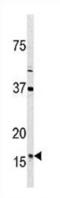 Thioredoxin 2 antibody, abx027384, Abbexa, Western Blot image 