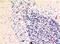 Microtubule Associated Protein 1 Light Chain 3 Beta antibody, GTX34068, GeneTex, Immunohistochemistry paraffin image 