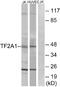 General Transcription Factor IIA Subunit 1 antibody, A09007, Boster Biological Technology, Western Blot image 