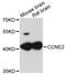 Cyclin E2 antibody, STJ22953, St John