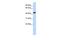Retinol Dehydrogenase 16 antibody, GTX47074, GeneTex, Western Blot image 